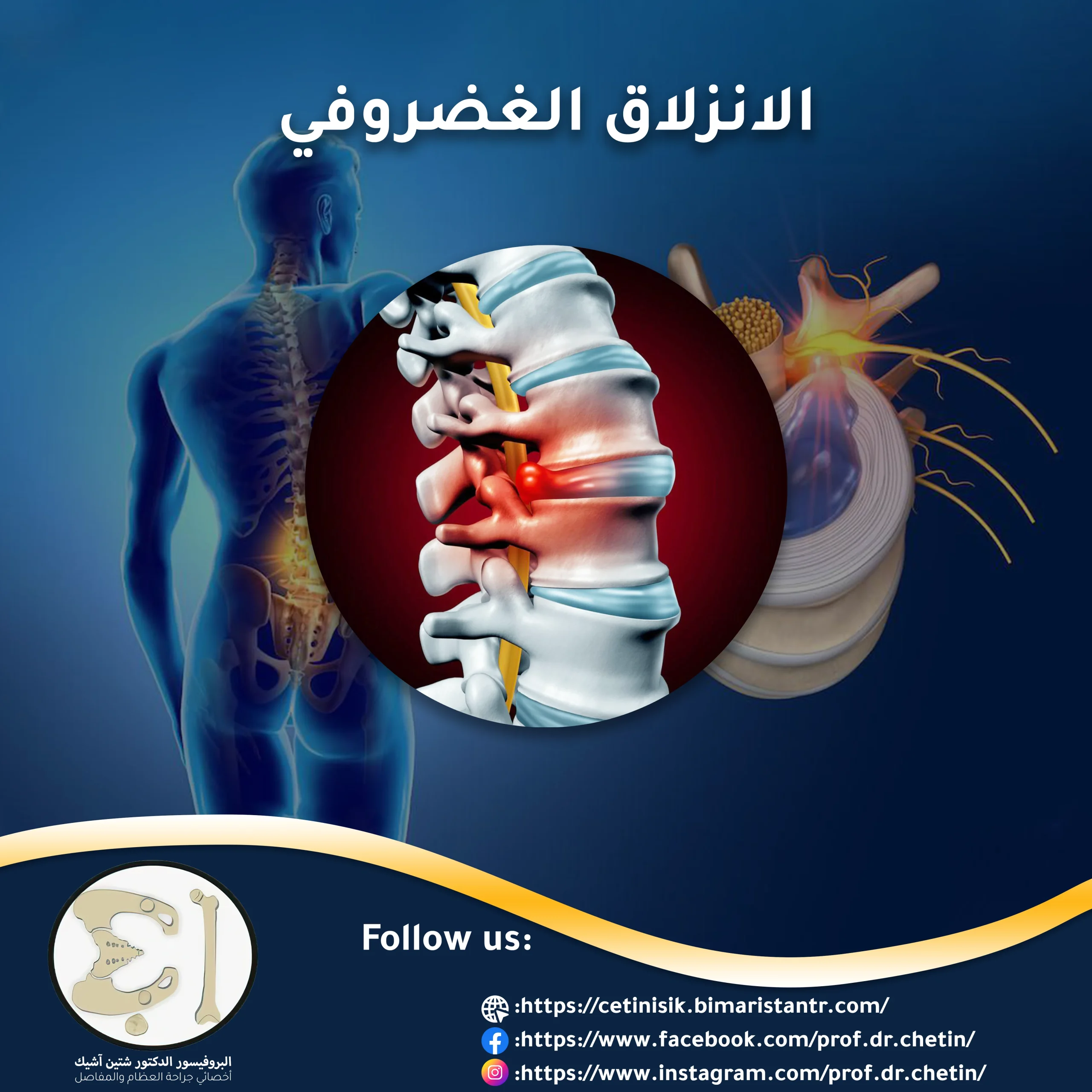 Treatment of herniated disc (disc) and its causes