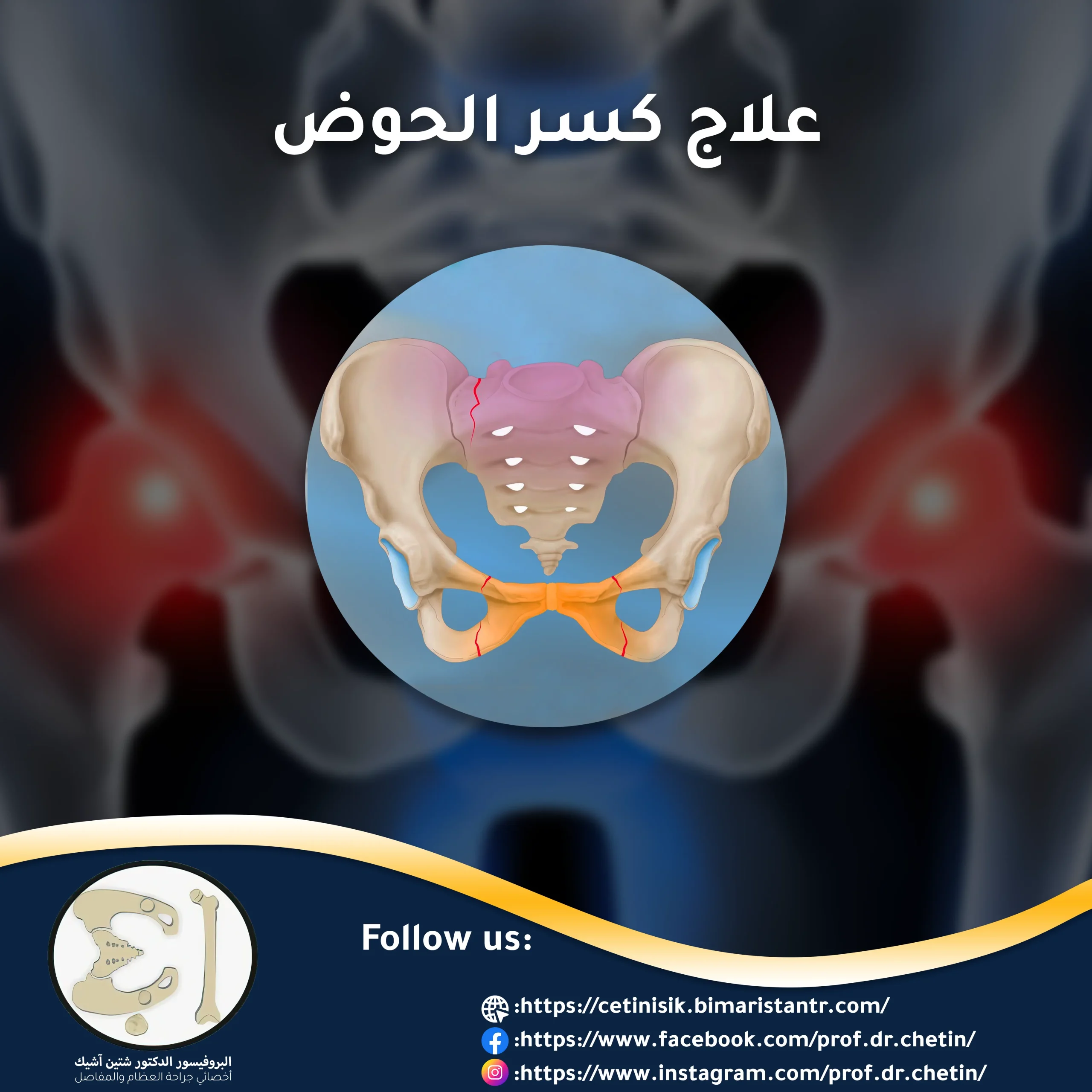 All you need to know about pelvic fracture treatment