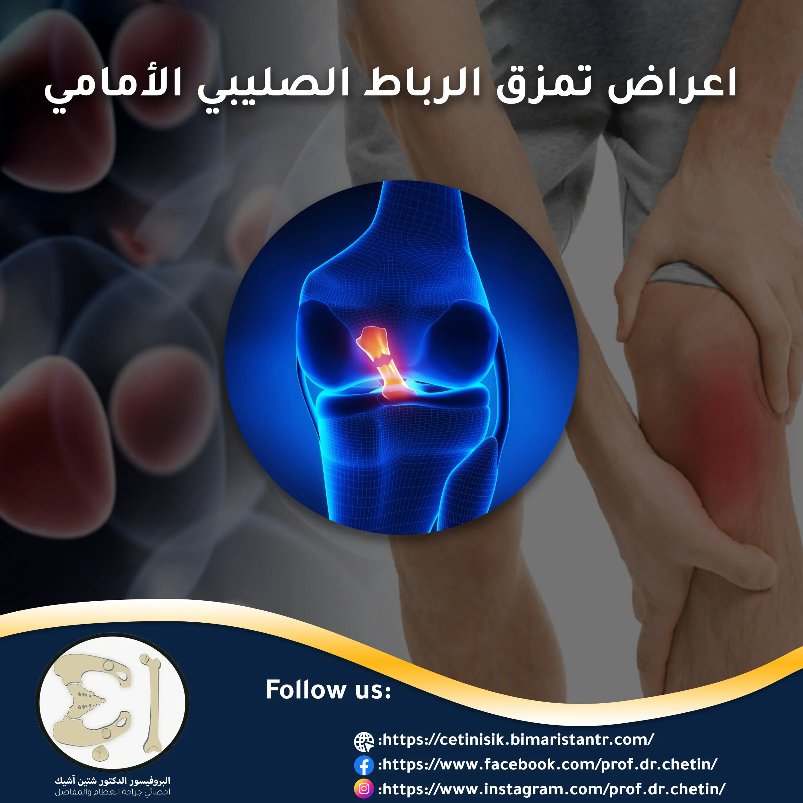 Symptoms and treatment of anterior cruciate ligament rupture