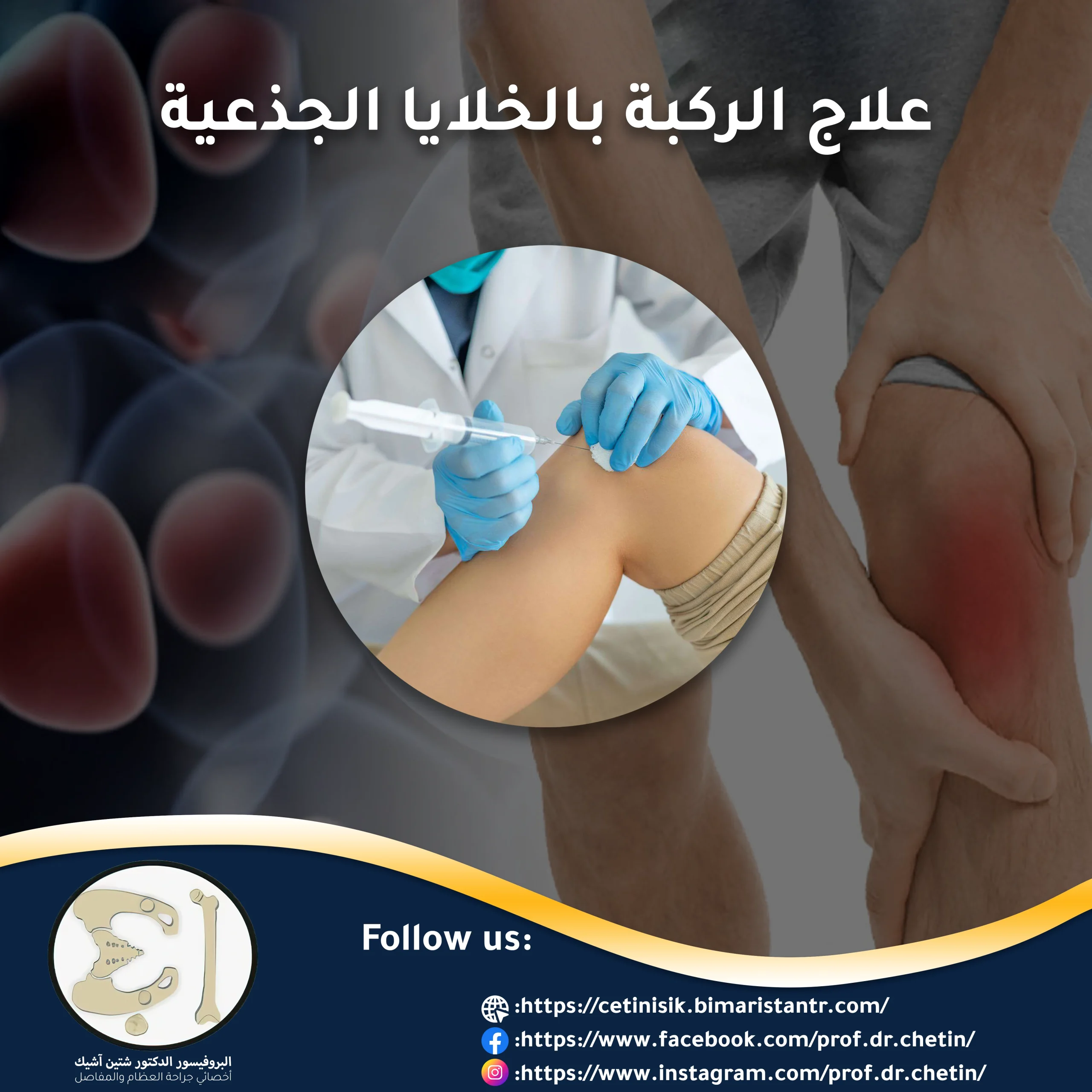 Knee stem cell treatment