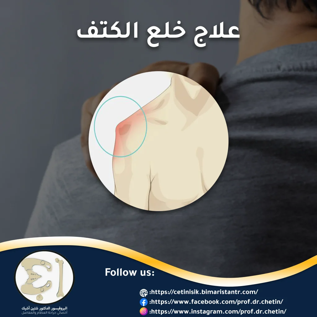 Shoulder dislocation treatment