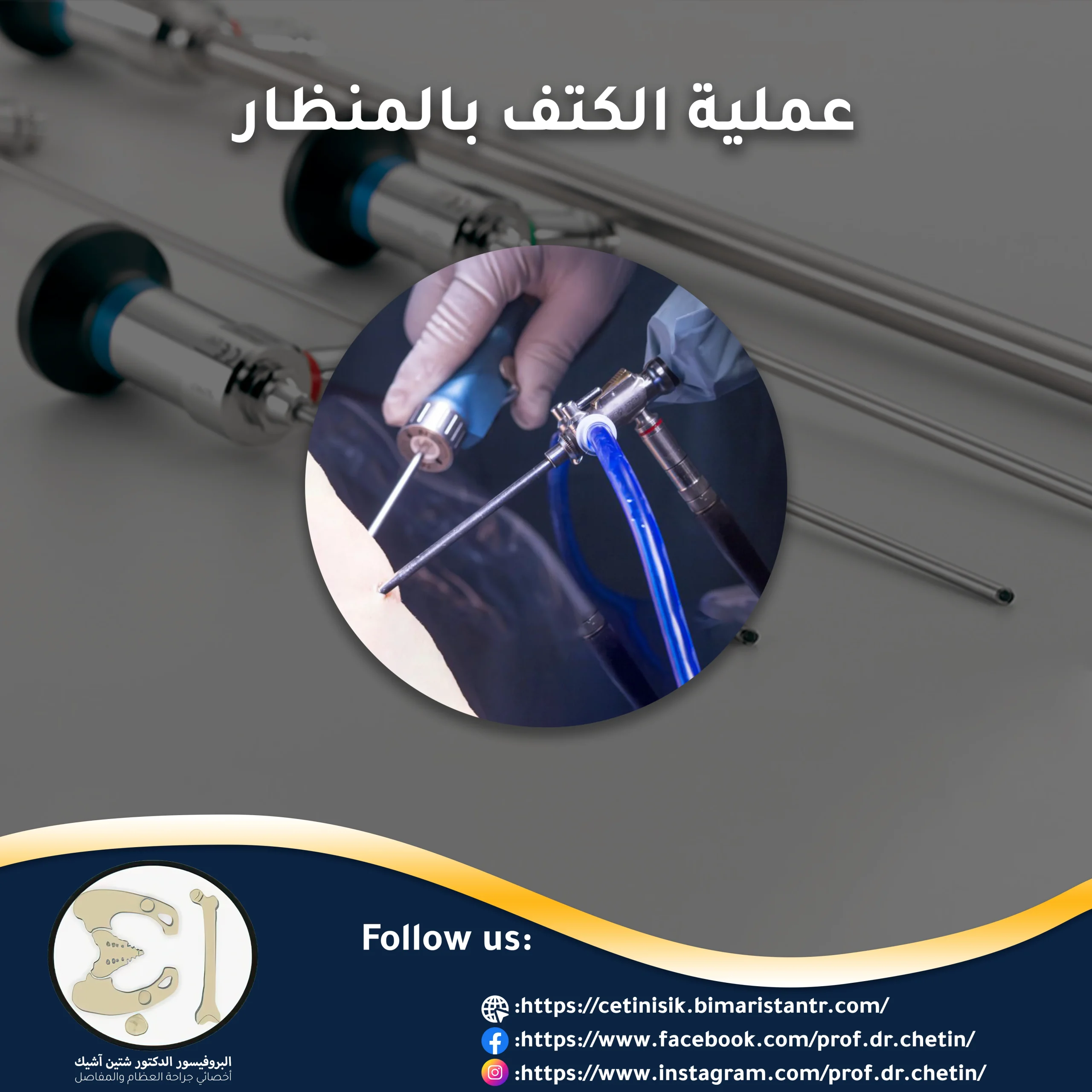 Shoulder arthroscopic surgery