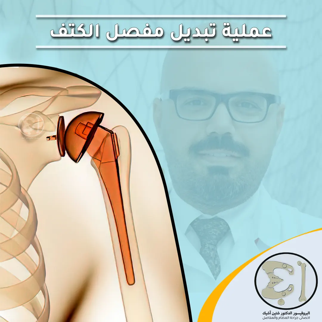 All details of shoulder replacement surgery