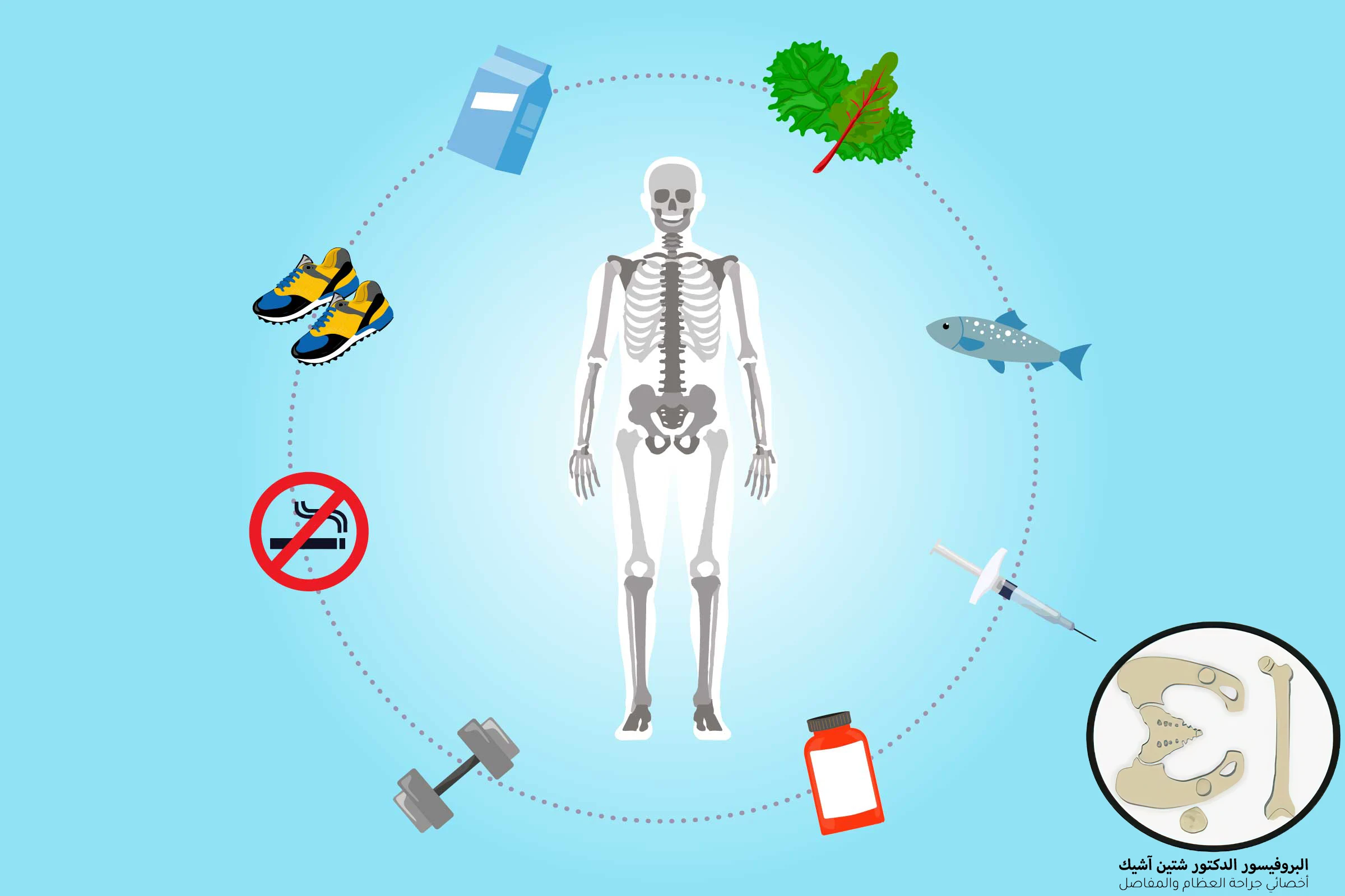 An image showing ways to prevent osteoporosis