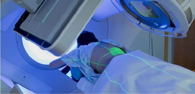 An image showing a patient undergoing radiotherapy