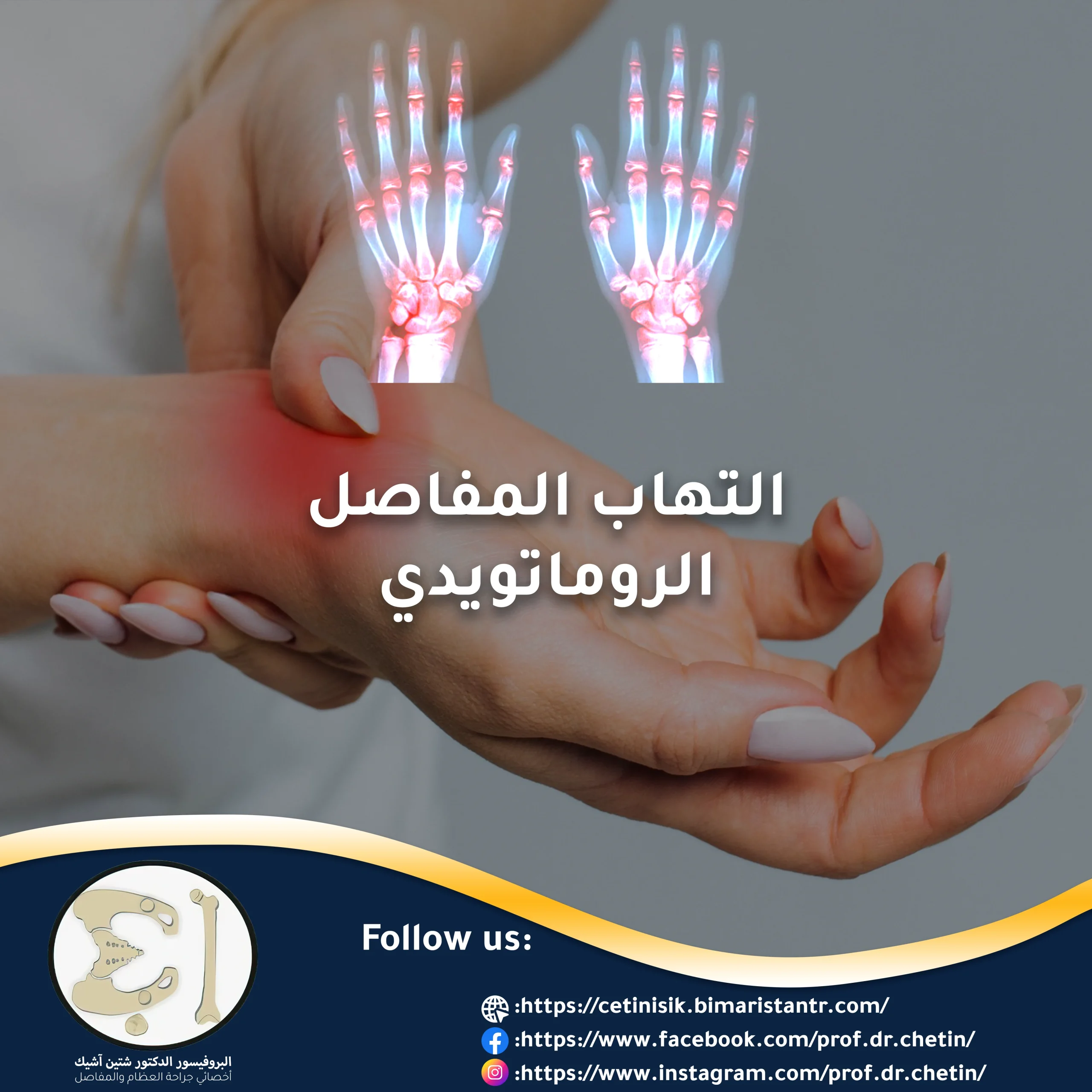 All about the diagnosis and treatment of rheumatoid arthritis