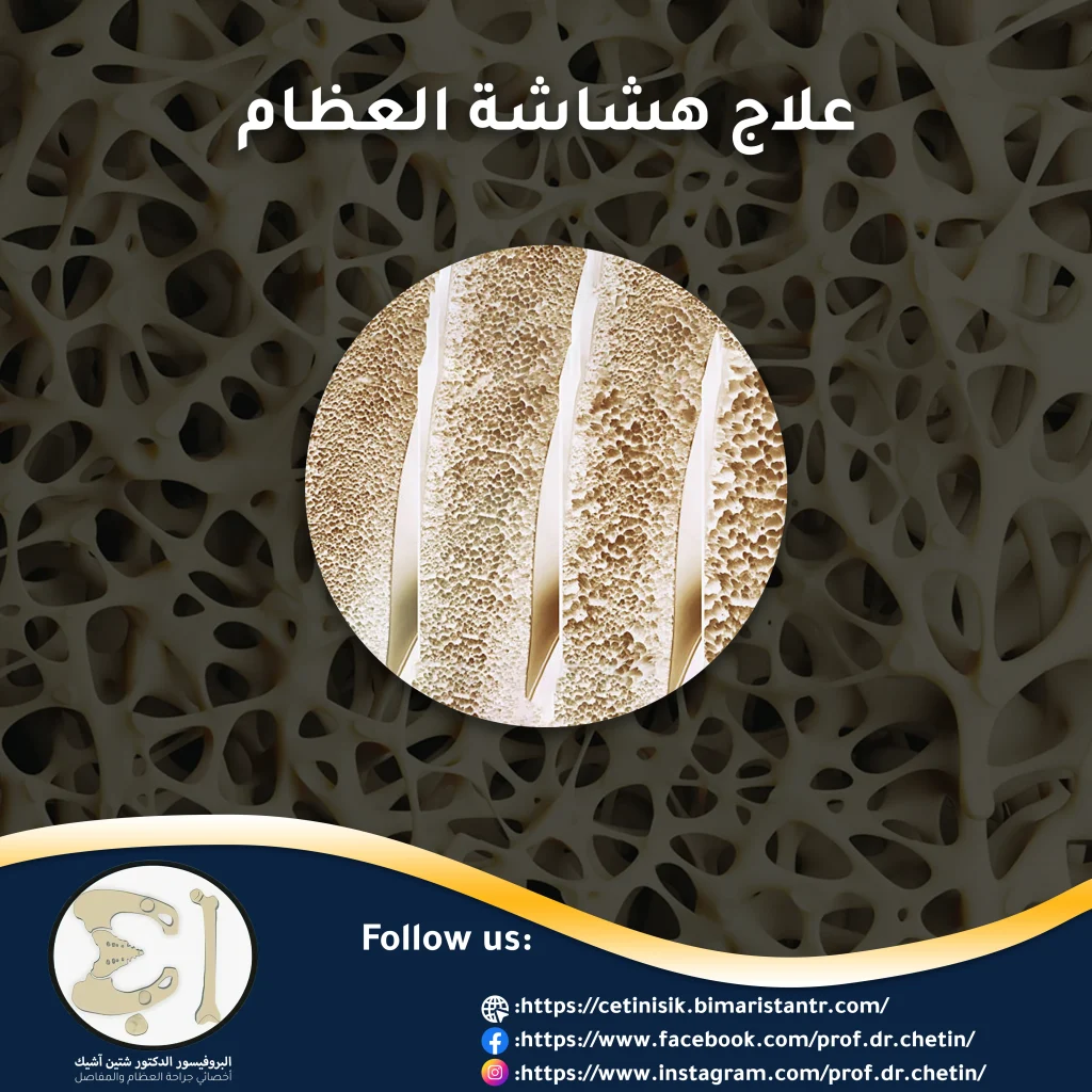 Picture showing a gradual decrease in bone density.
