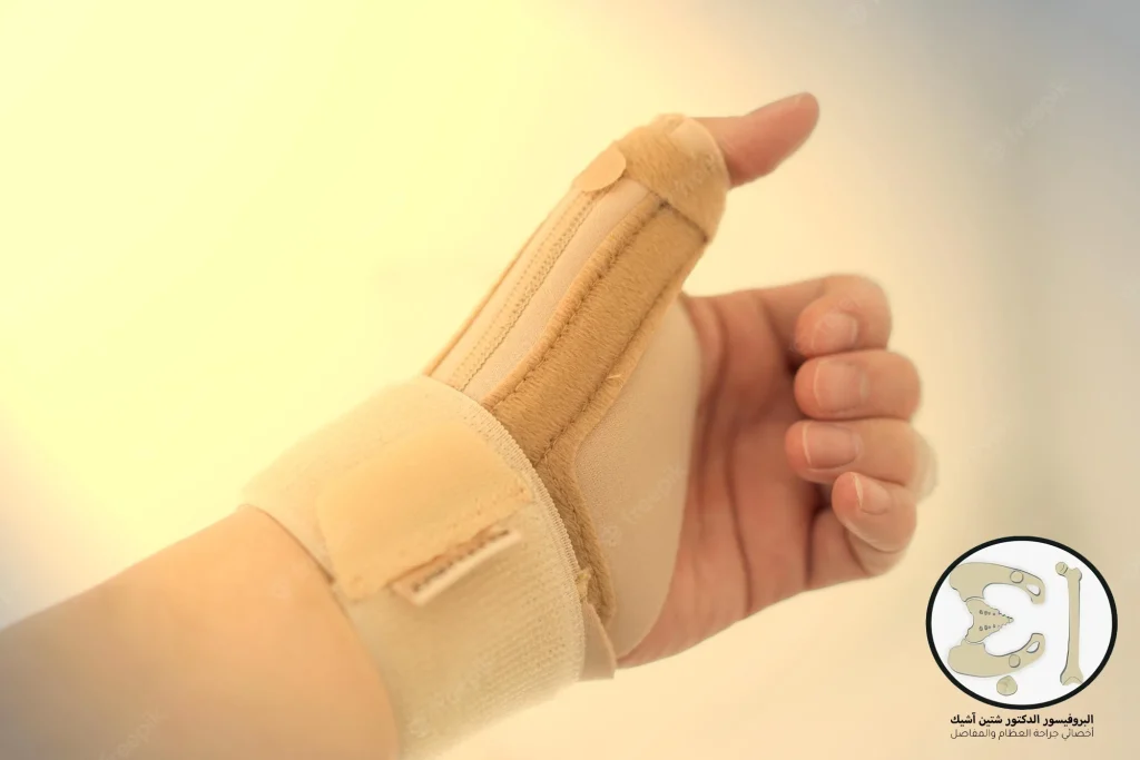 Thumb splint for de Quervain's syndrome 