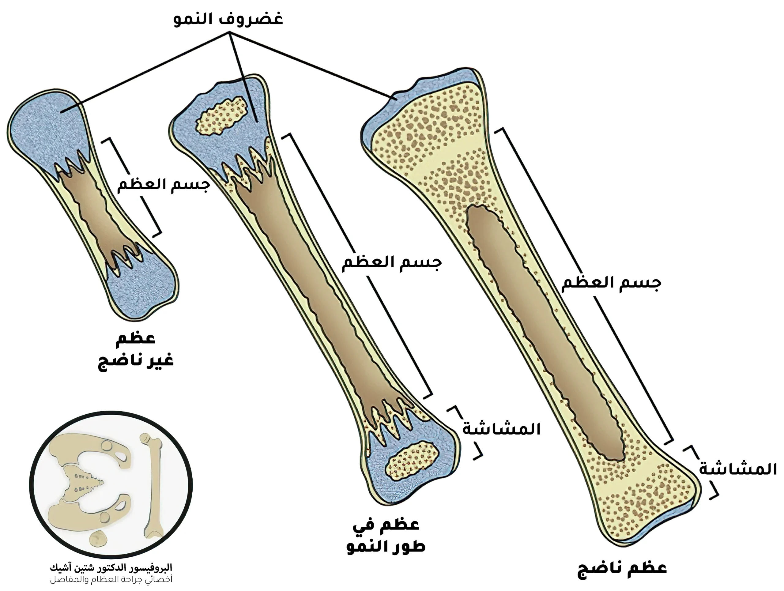 يمكن تصنيف أنواع العظام من حيث التركيب إلى عظم أولي غير ناضج في المرحلة الجنينية يستبدل بعظم الثانوي ثانوي ناضج عند البلوغ