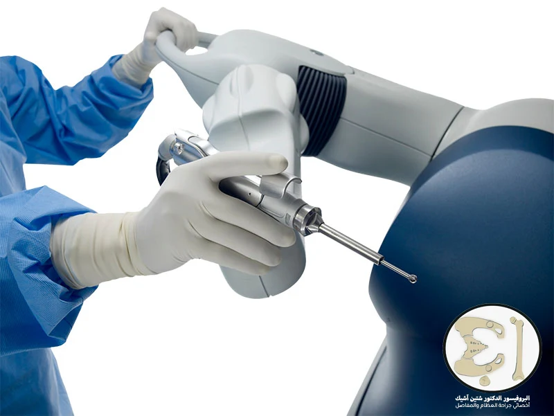 Image showing the robot used in knee replacement surgery