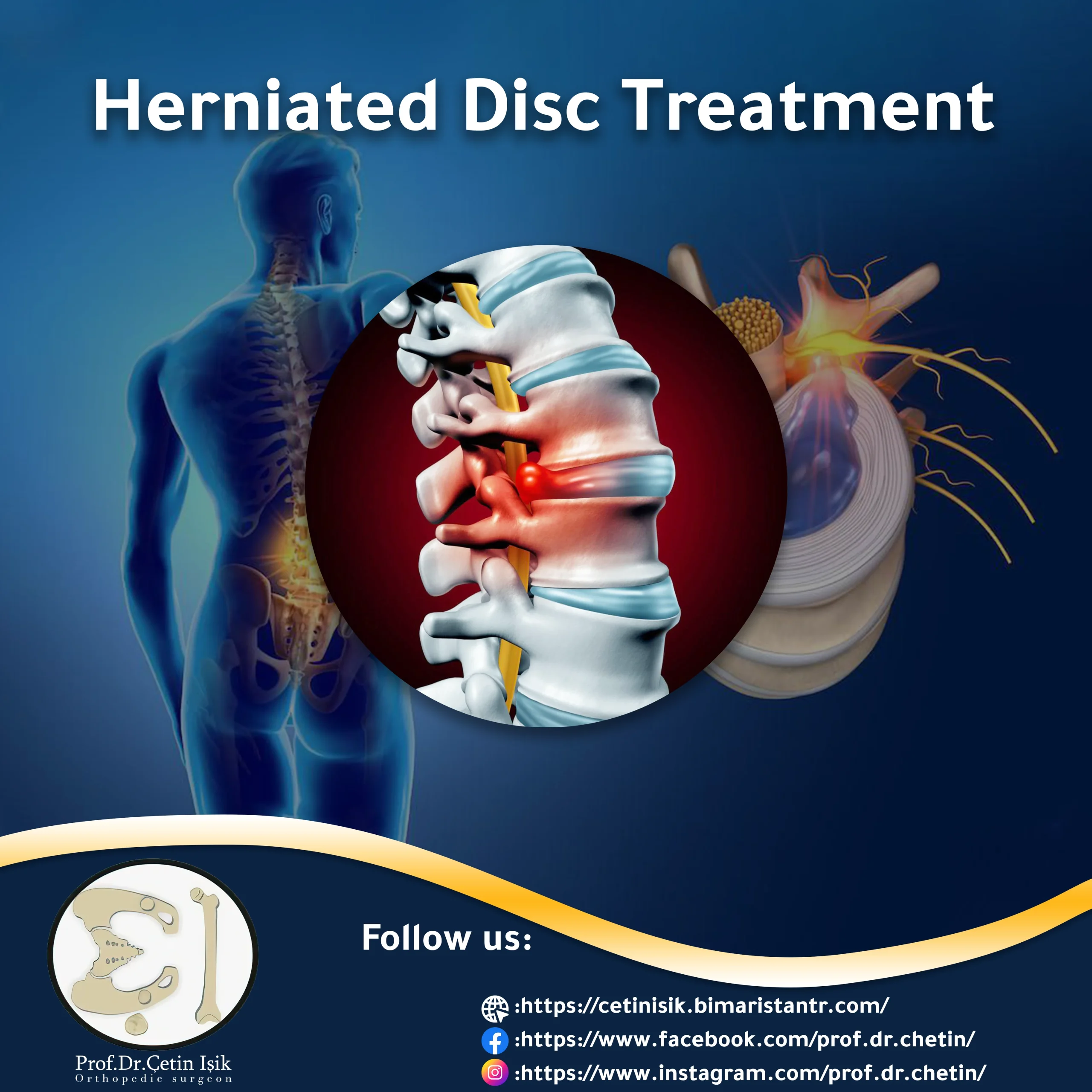 Herniated Disc  Neurological Surgery
