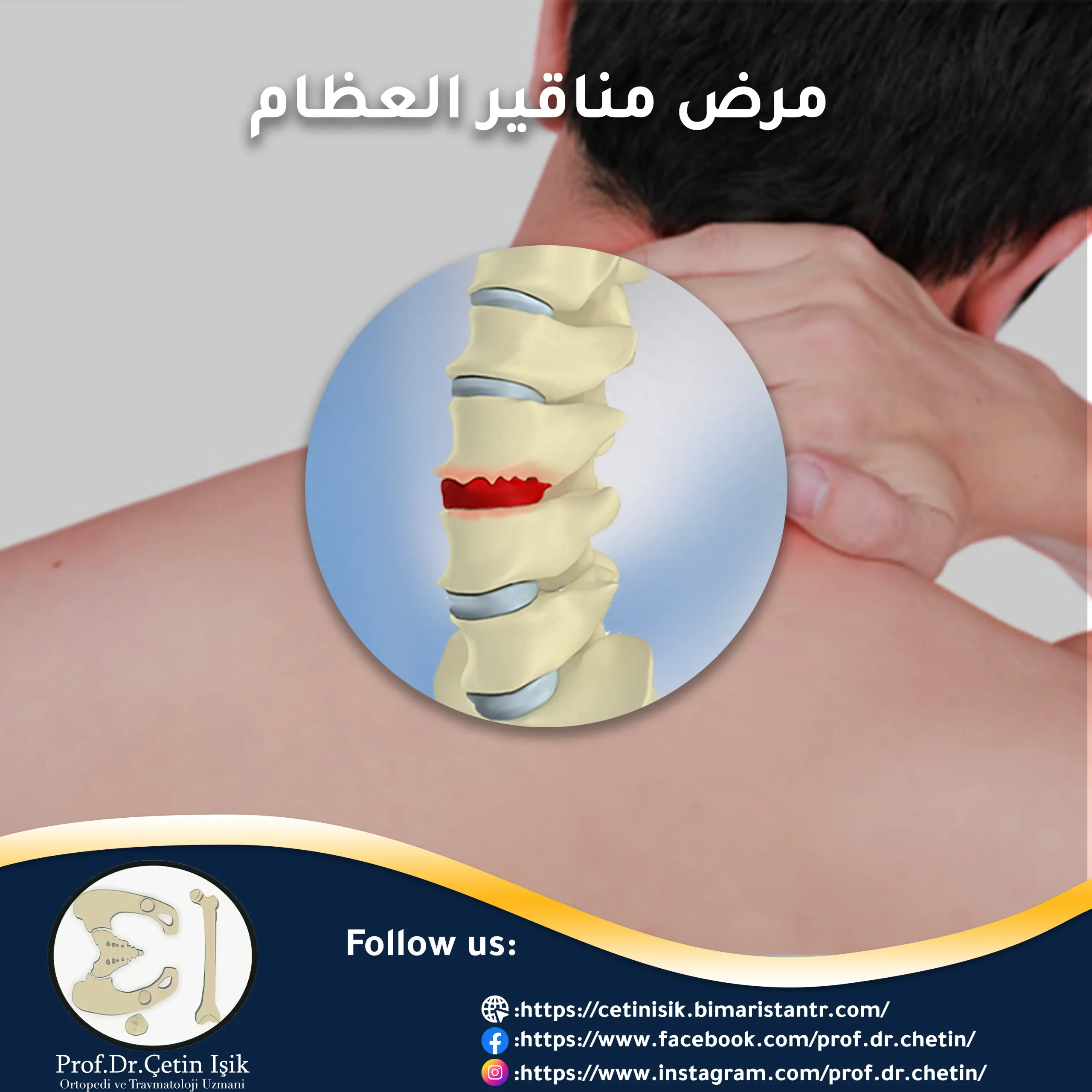 Neck spurs disease and its problems