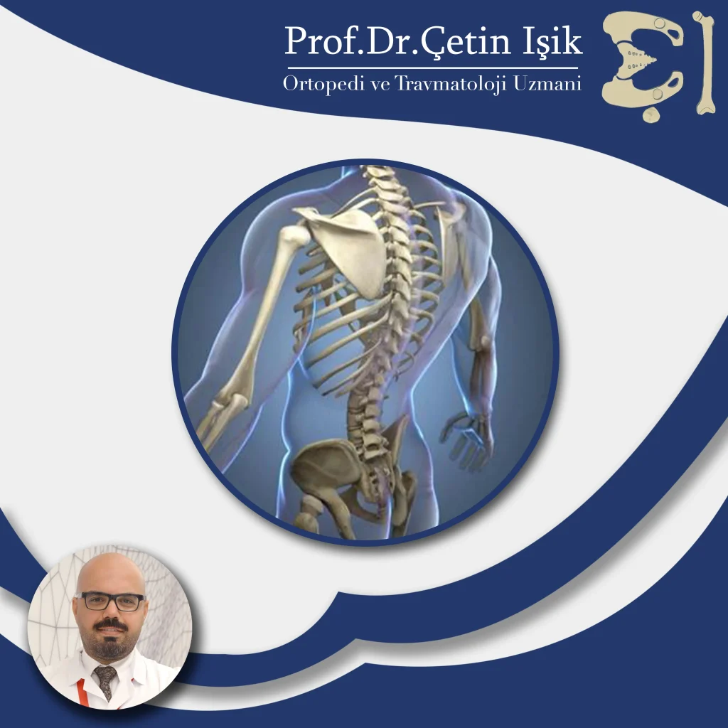 Treatment of diseases of the musculoskeletal system in Istanbul by Dr. Cetin Isik