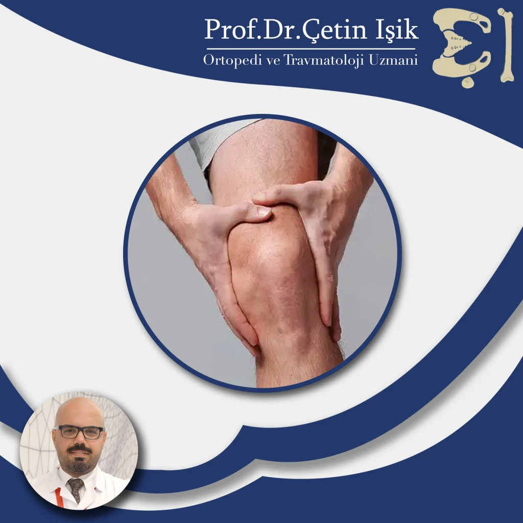 Treatment of knee joint diseases in Istanbul by Dr. Cetin Isik