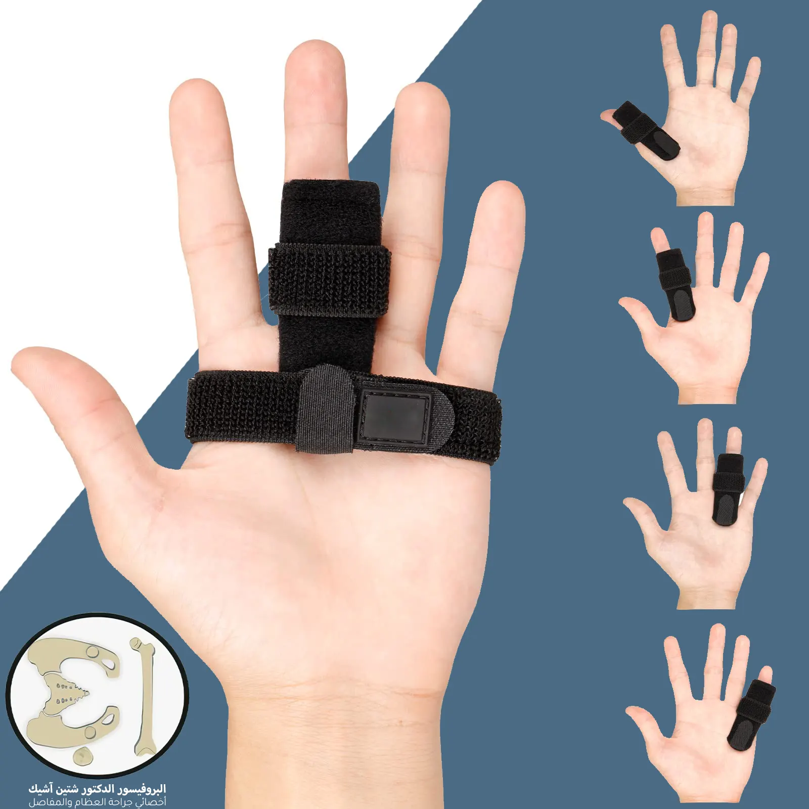 يمكن أن توضع الدعامات على أي إصبع من أصابع اليدين من أجل علاج تيبس مفاصل الأصابع