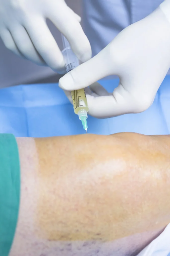 A picture showing the correct and correct method of injecting plasma into the knee