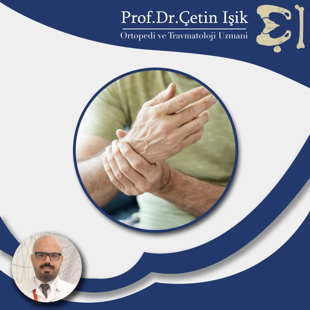Treatment of diseases of the joints of the hand and wrist