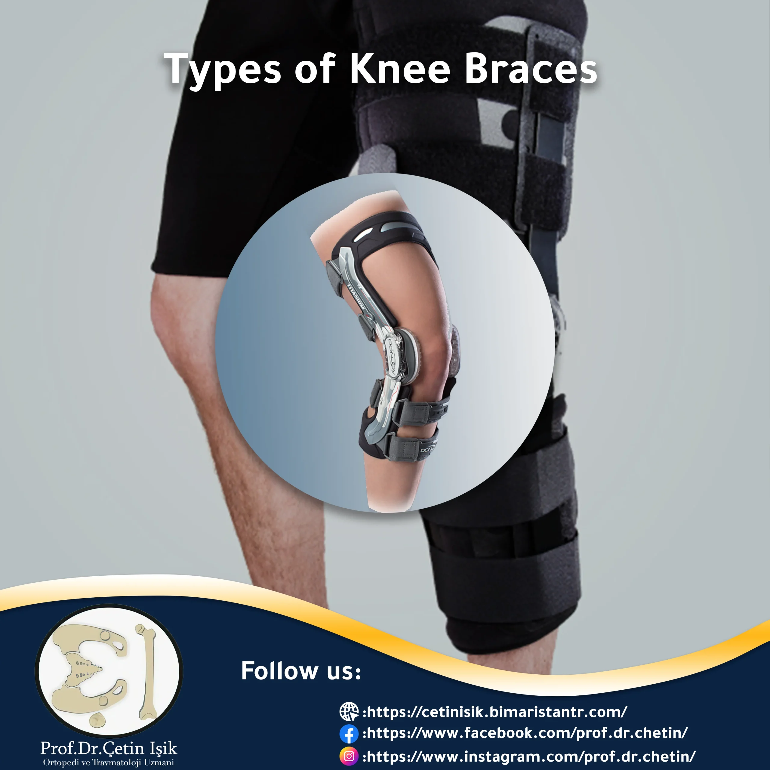 Image showing the types of knee braces