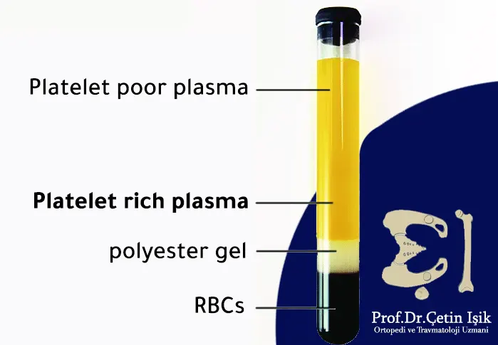 Image showing the composition of platelet rich plasma