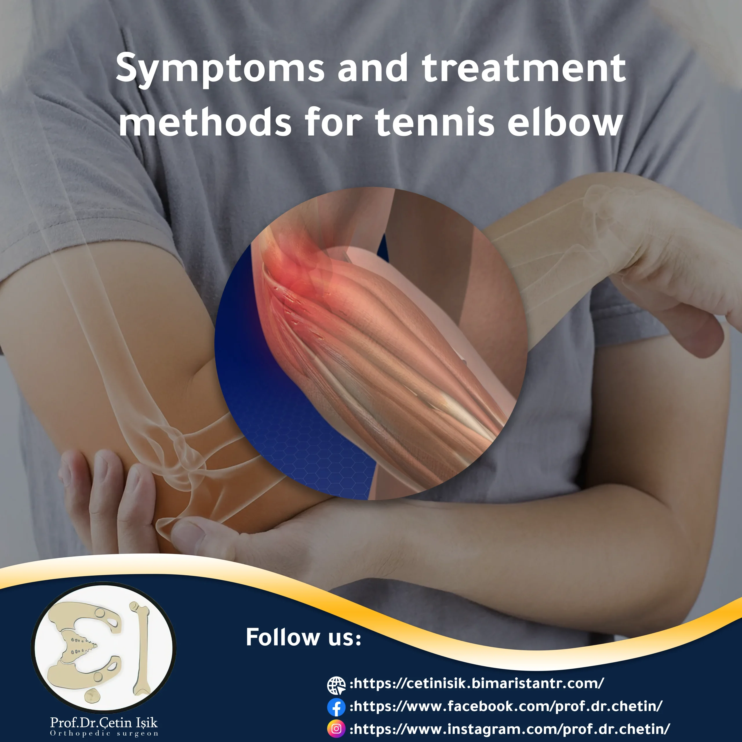 Picture of an article on the symptoms and treatment of tennis elbow