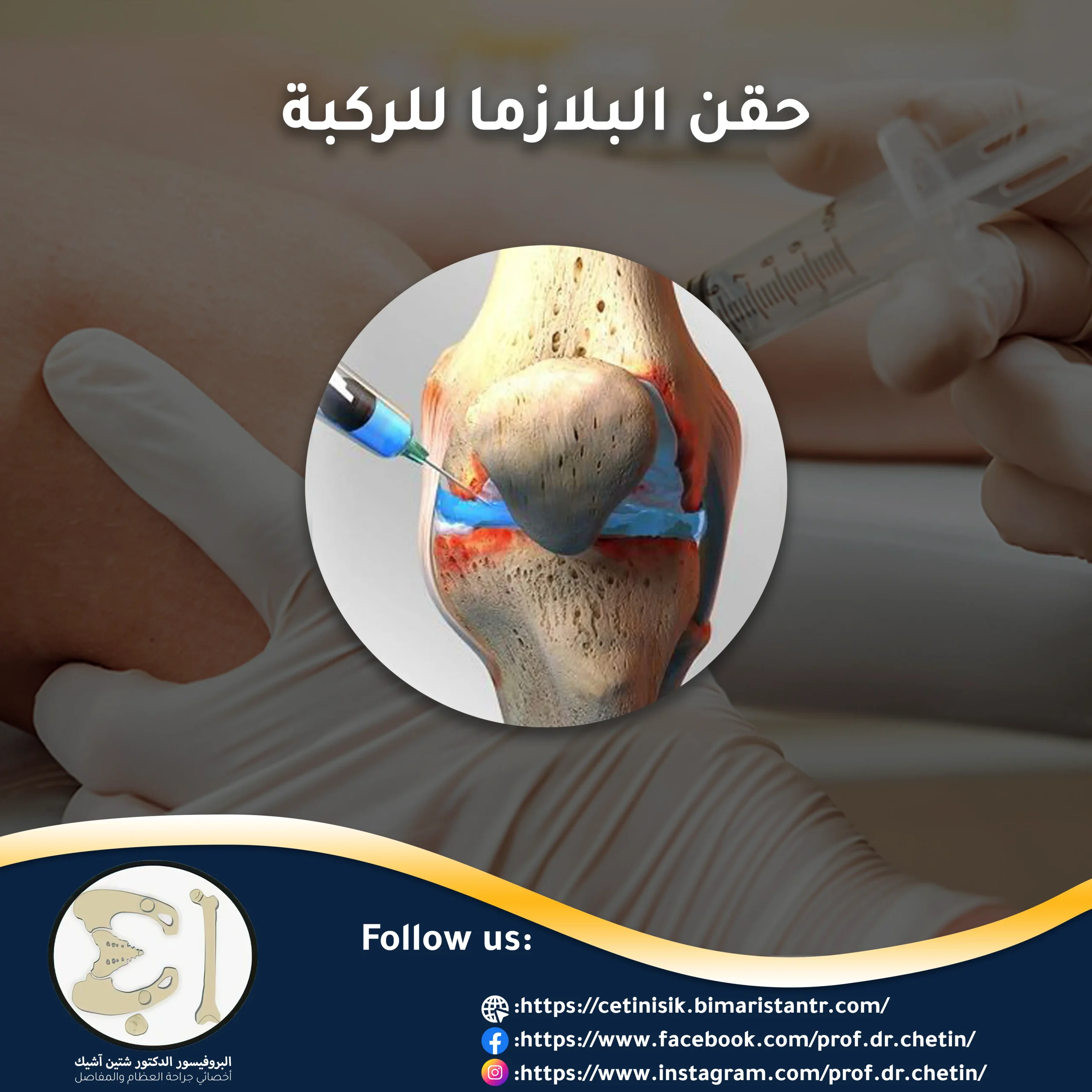 Knee plasma injection