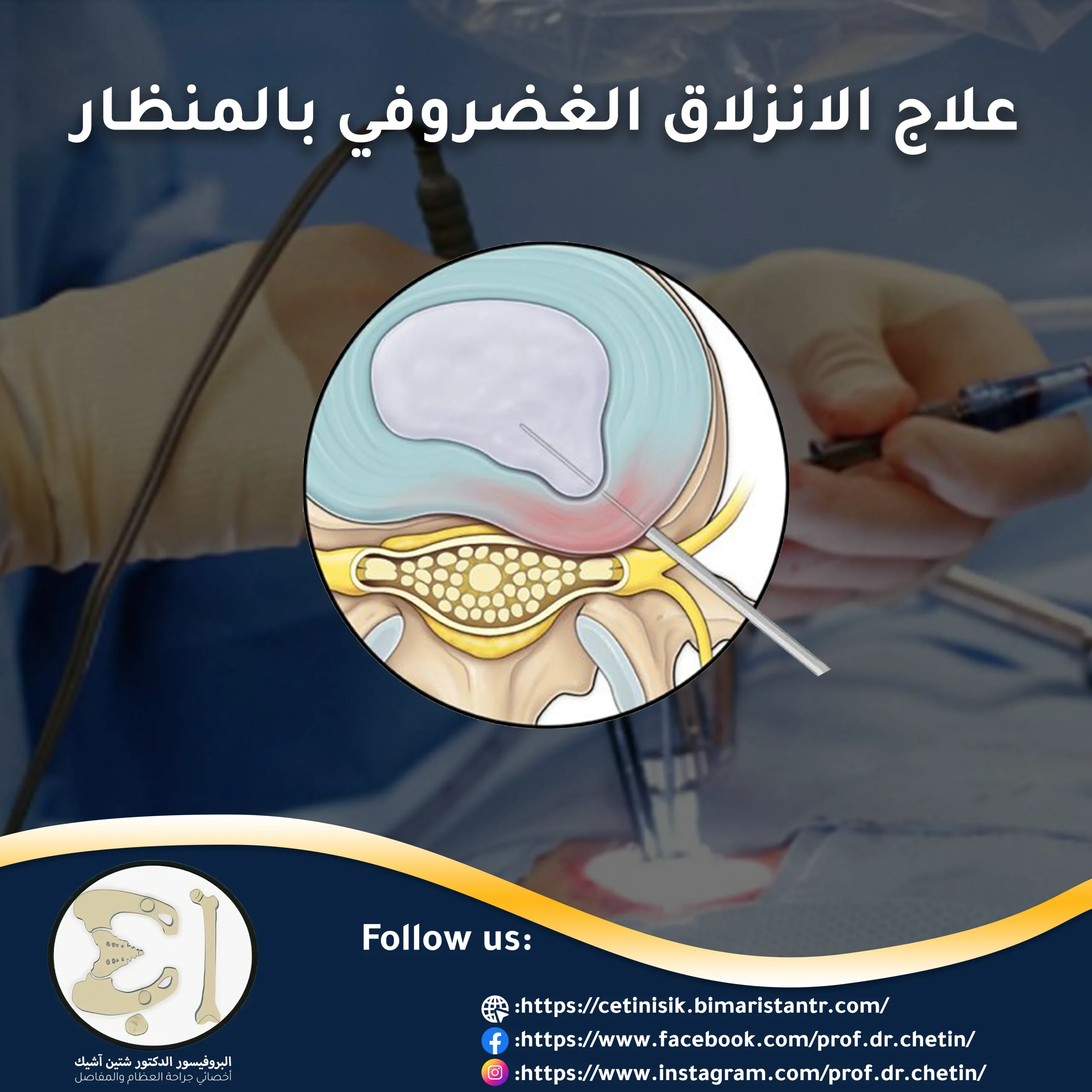 Endoscopic treatment of herniated disc