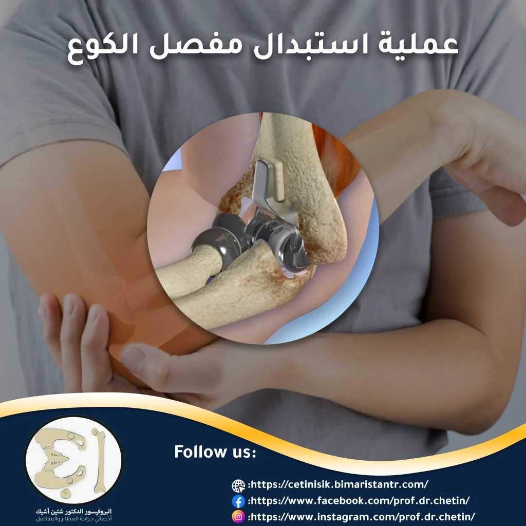 Image showing the artificial elbow joint