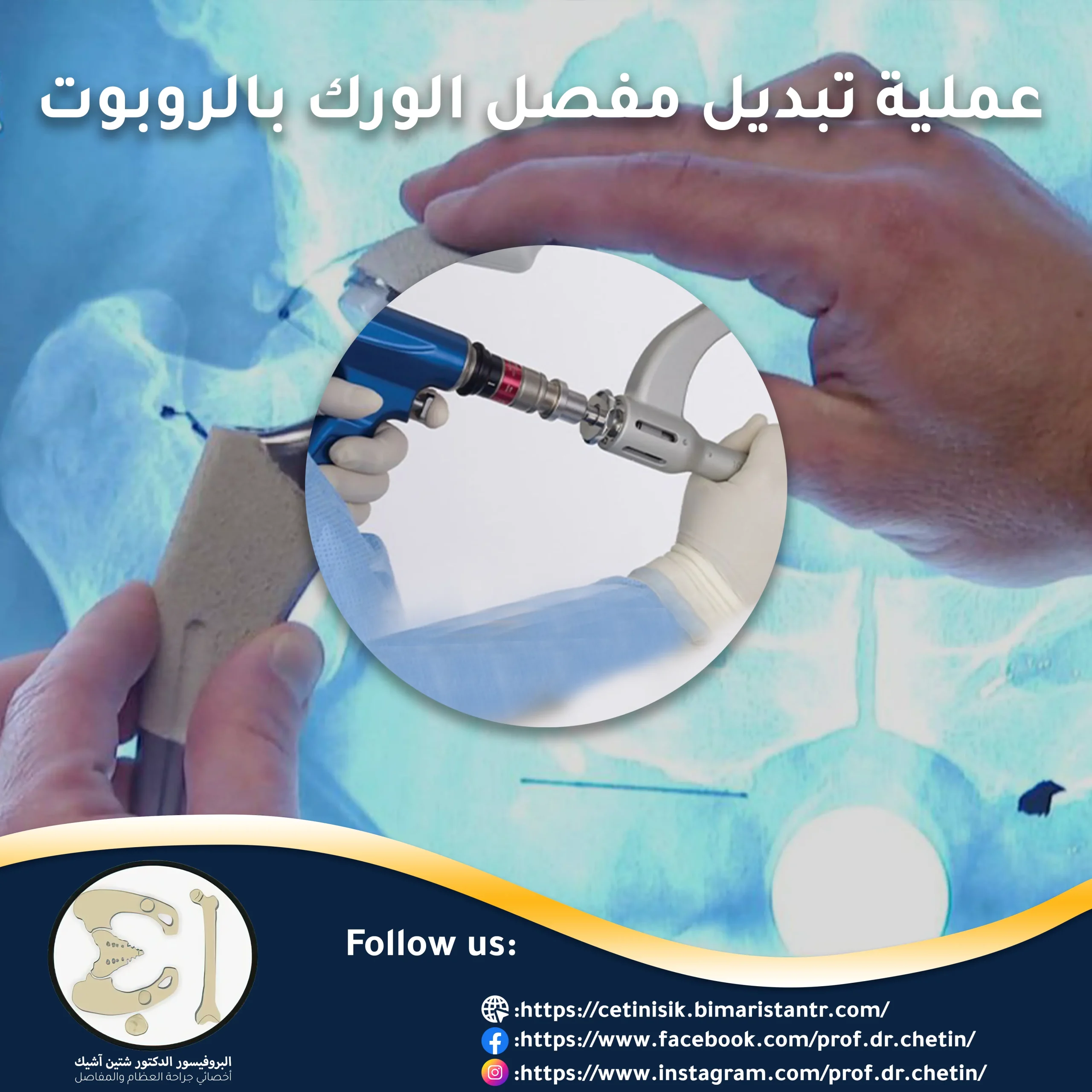 Robotic hip replacement surgery