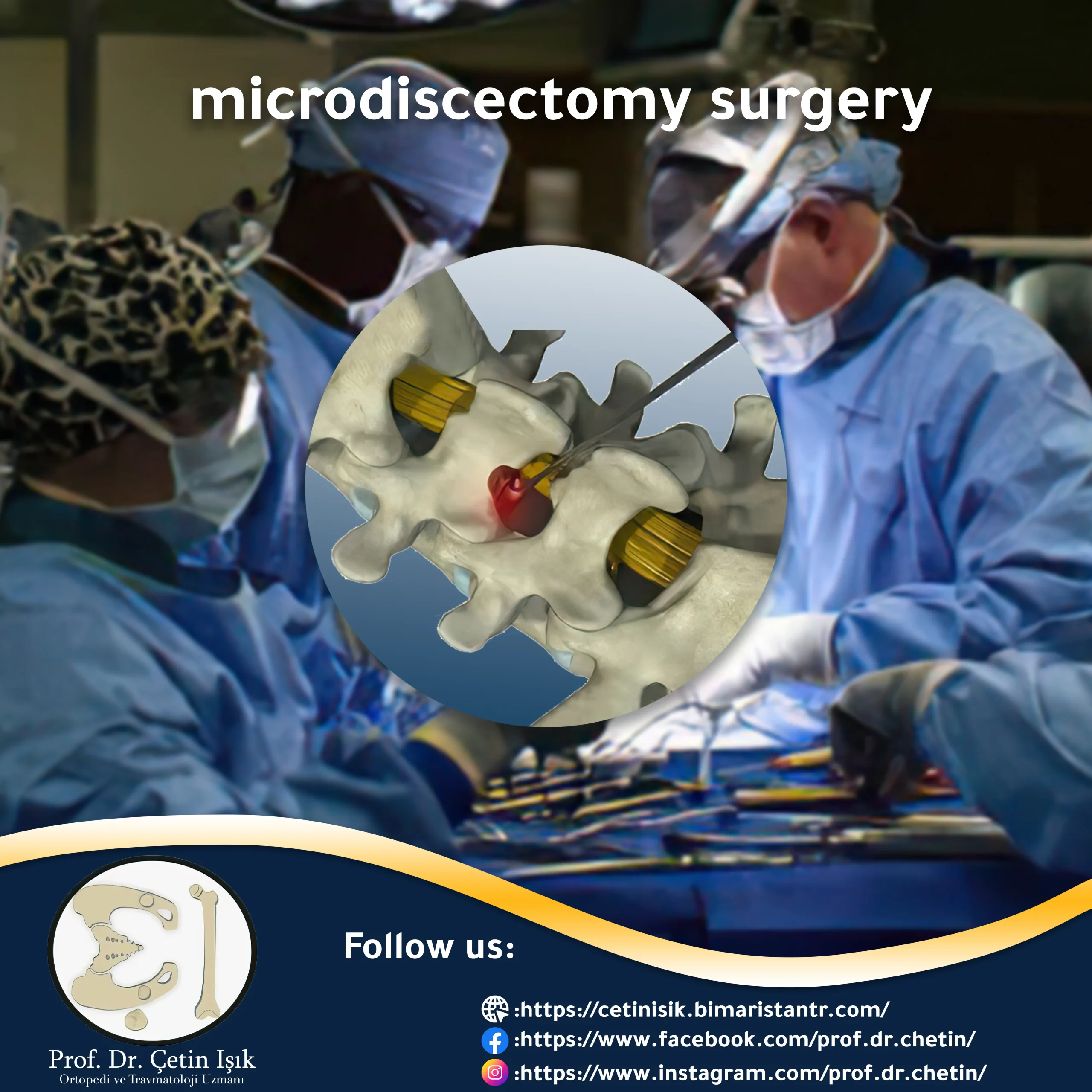 Microdisk surgery article image