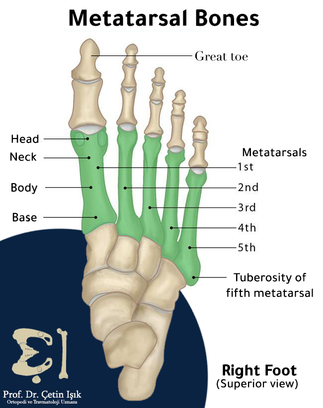 We notice from the picture the five metatarsals, as well as the head, neck, body, and base of the metatarsal  
