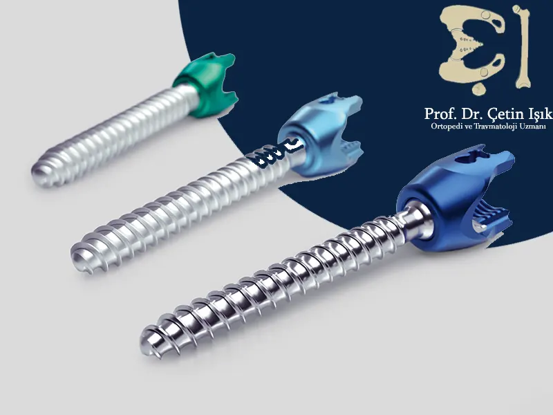 An image showing the different types of screws used in vertebrae fixation operations, as there are various sizes used according to the vertebrae that need fixation