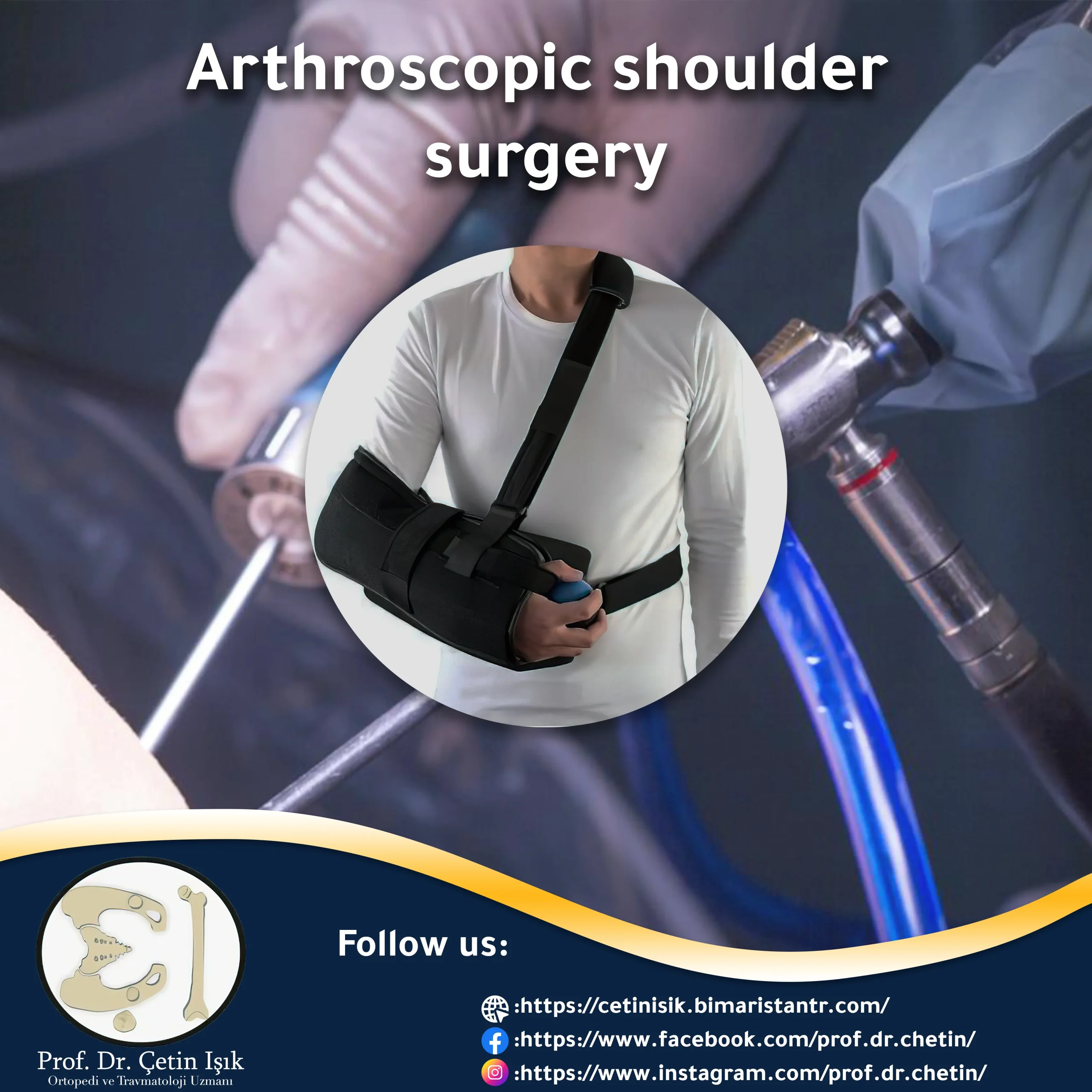 Shoulder arthroscopic surgery
