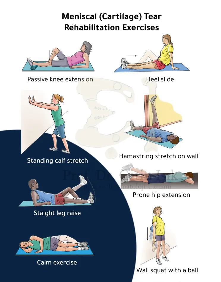 An image showing the physiotherapy exercises applied in physical therapy for the meniscus of the knee, after or without surgery
