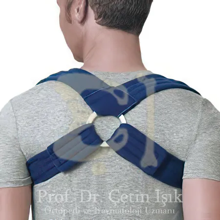 The No. 8 clavicle brace is used to stabilize the shoulder