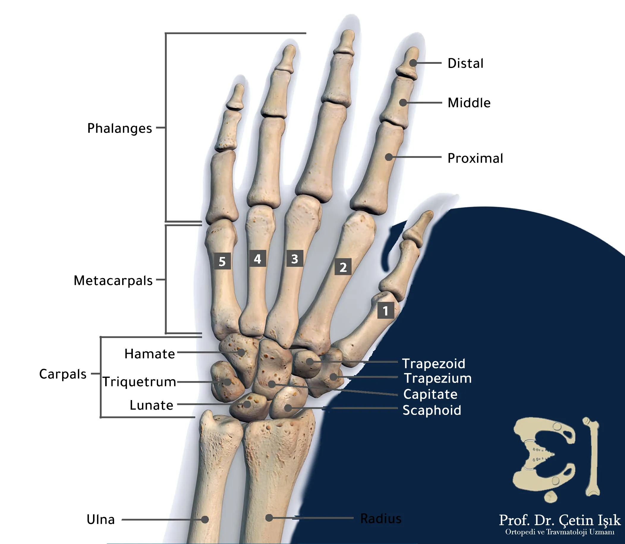 We notice from the picture that the joint of the hand consists of seven carpal bones, which are the triangular, large, canine, scaphoid, quadrate, trapezoid and lunate. The ulna and the humerus are also involved in its lower end in the joint of the hand.