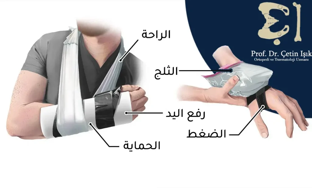 تشمل التدابير العلاجية لالتواء مفصل اليد: الراحة، رفع الذراع، كمادات الثلج، تطبيق ضغط وحماية اليد