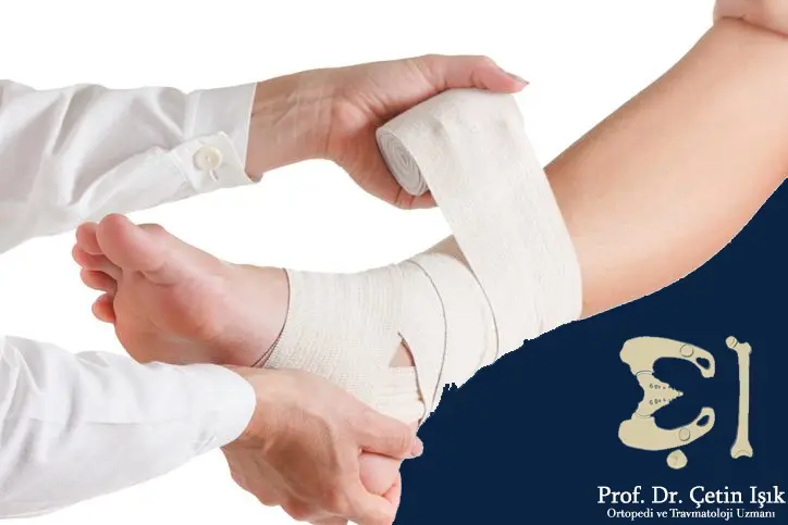 One of the first aid measures is the application of a compression bandage to treat torn ligaments in the ankle