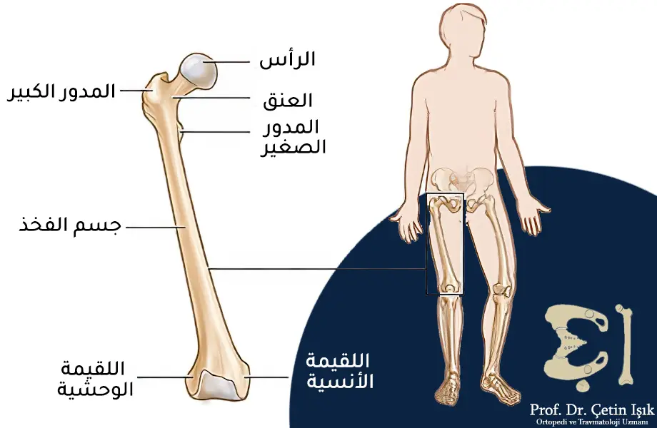 An image showing the location and components of the femur, including the head, neck, trochanter, body and epicondyles