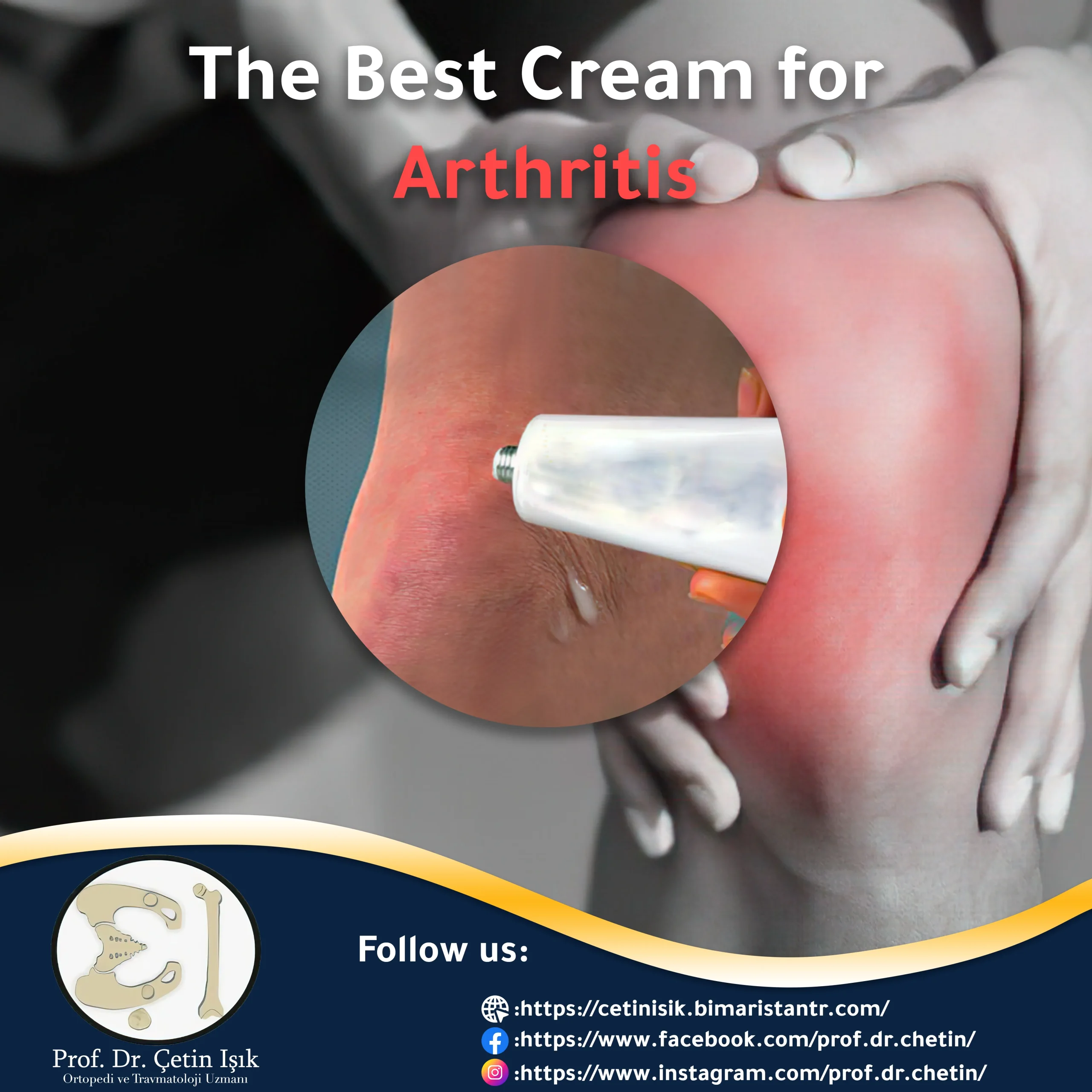 The Best Cream for Arthritis in Pharmacies 2022