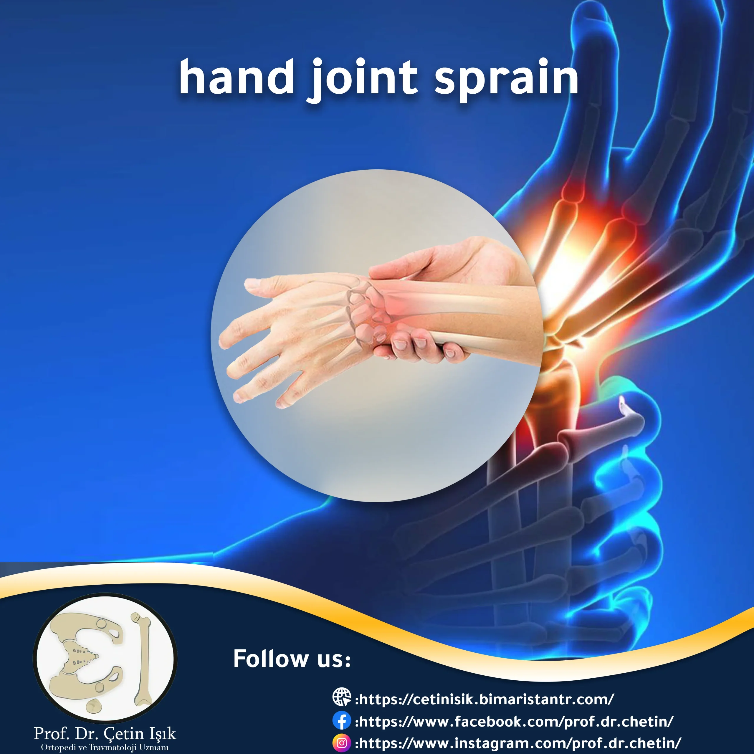 hand (wrist) joint sprain
