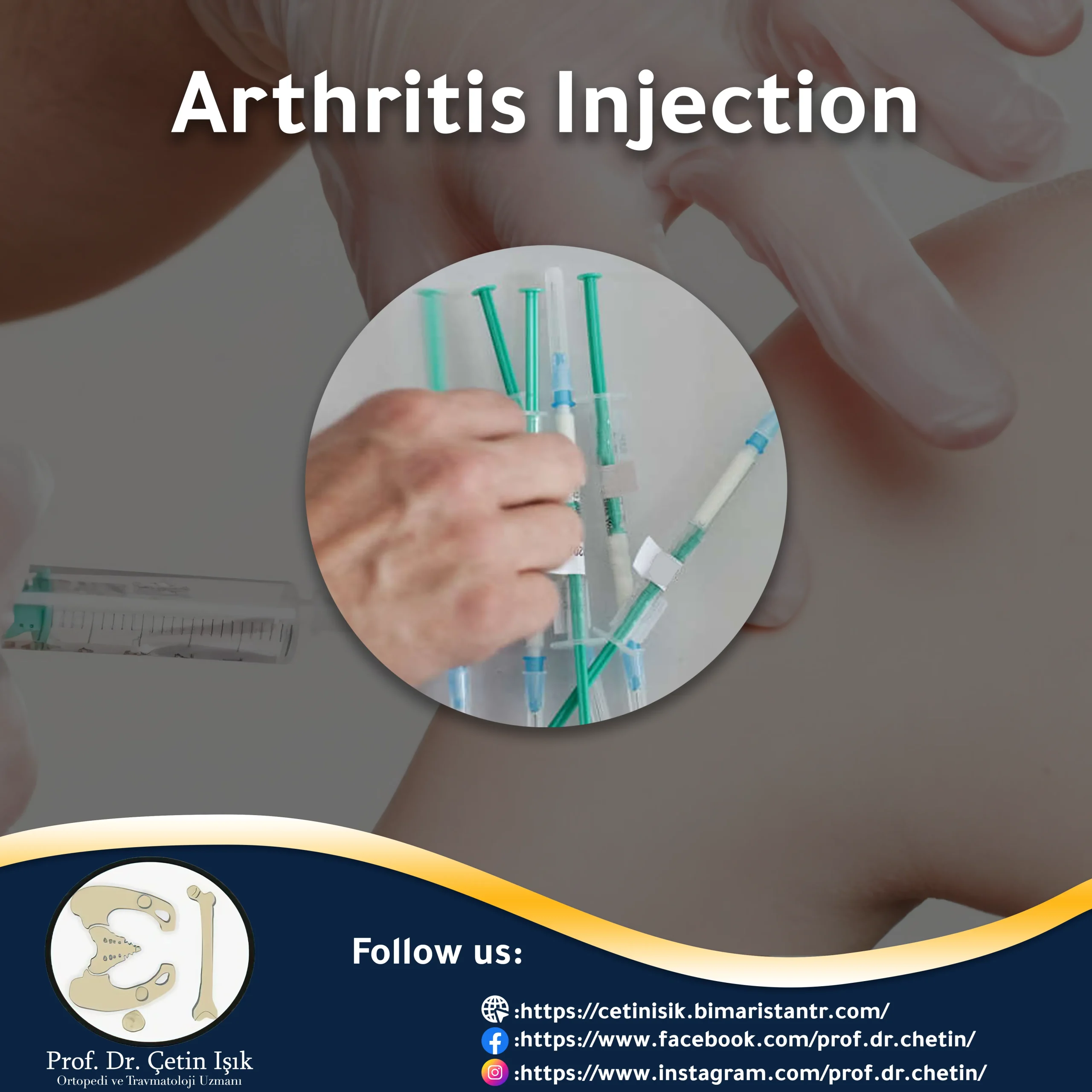 Arthritis Injection: Types of Joint Injections