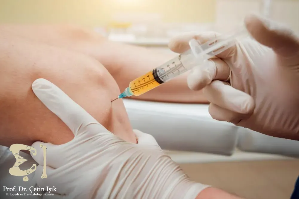 A steroid injection into the knee joint, steroid injections are the most common and used arthritis injections