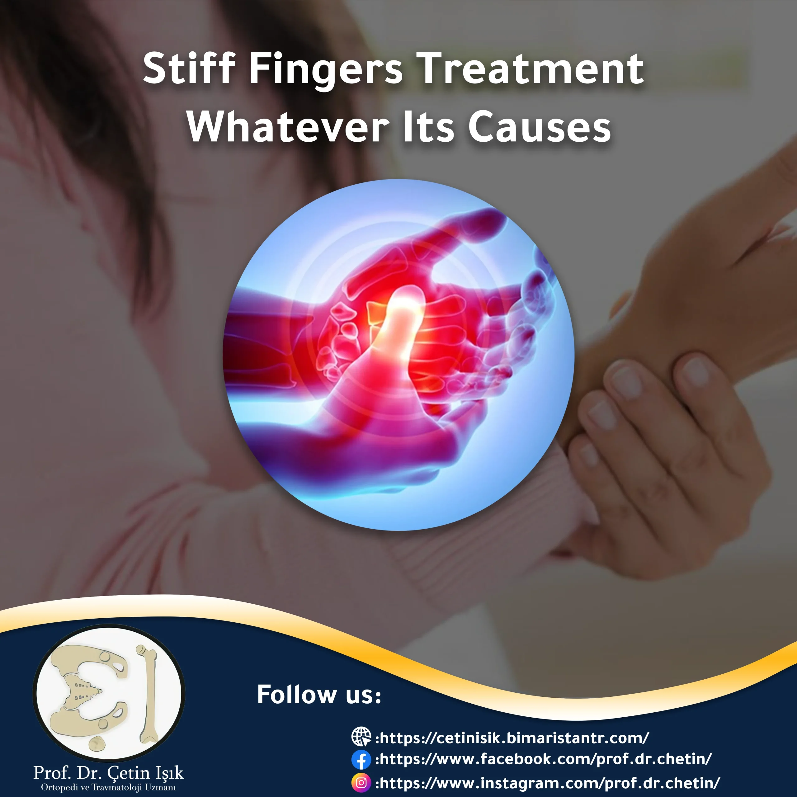 Stiff Fingers Treatment Whatever Its Causes