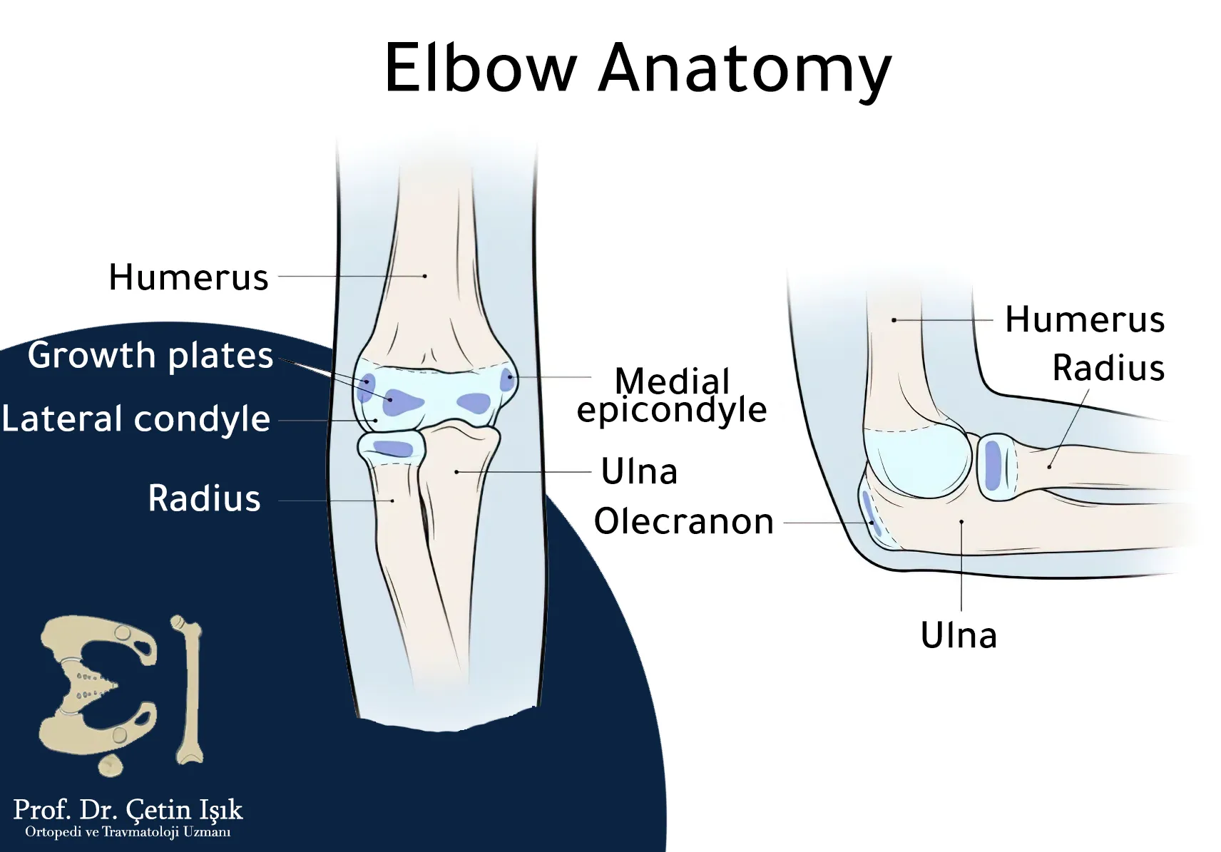 The image shows the components of the elbow joint, including the radius, ulna, and the distal end of the humerus