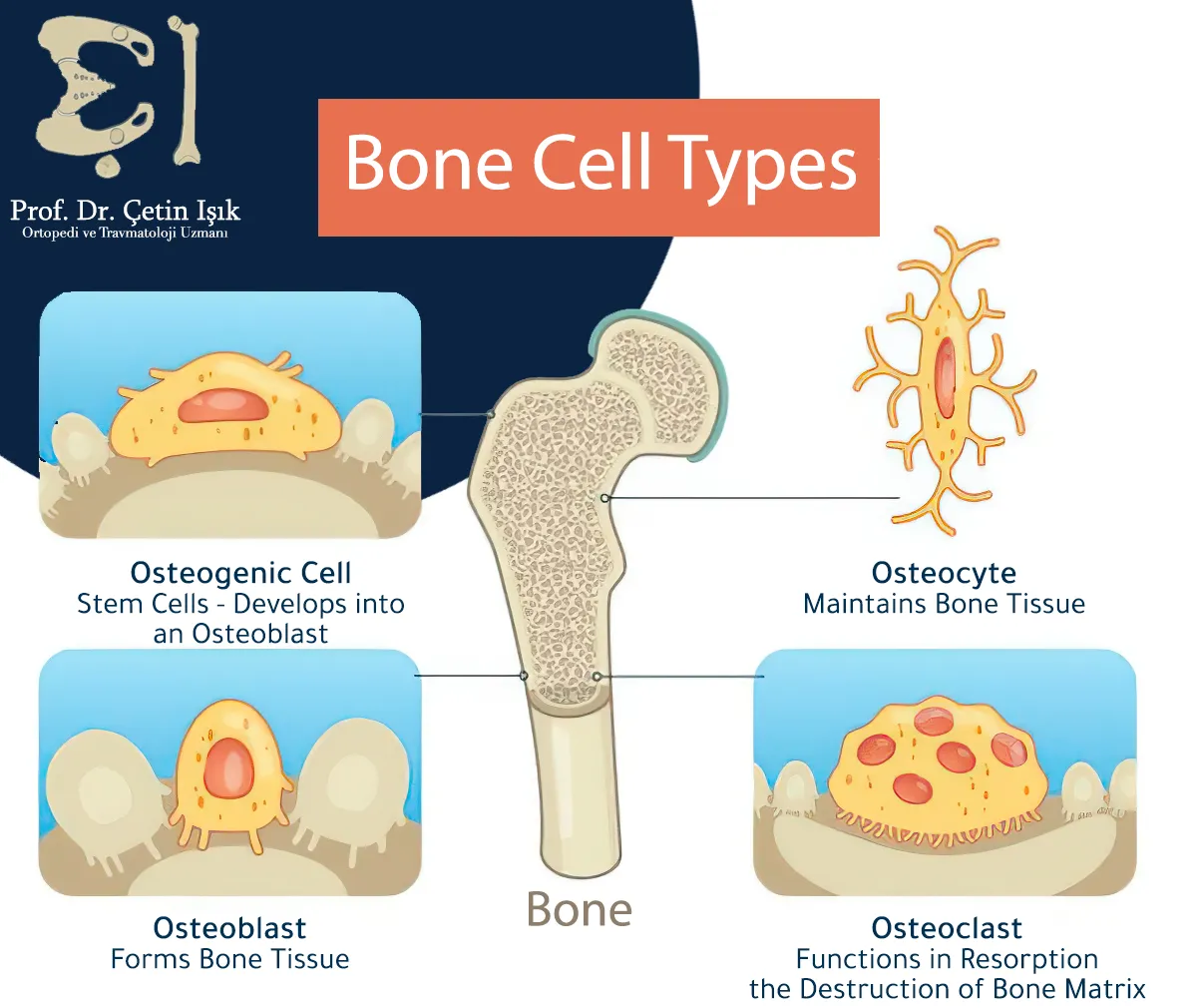 Bones generally consist of osteocytes, osteogenic cells, osteoclasts, osteoblasts, and the matrix that fills the space between the cells.