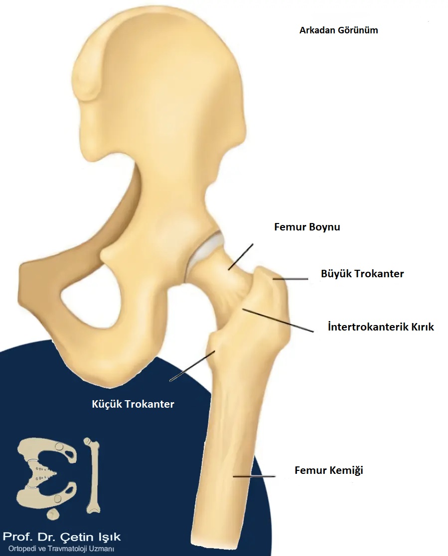 Femur Boyun K R Nas L Te His Edilir Ve Nas L Tedavi Edilir Prof