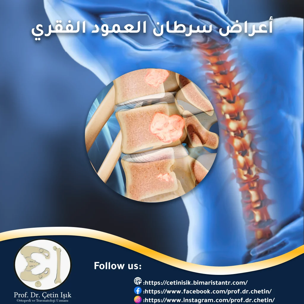 Symptoms of spine cancer and how it appears