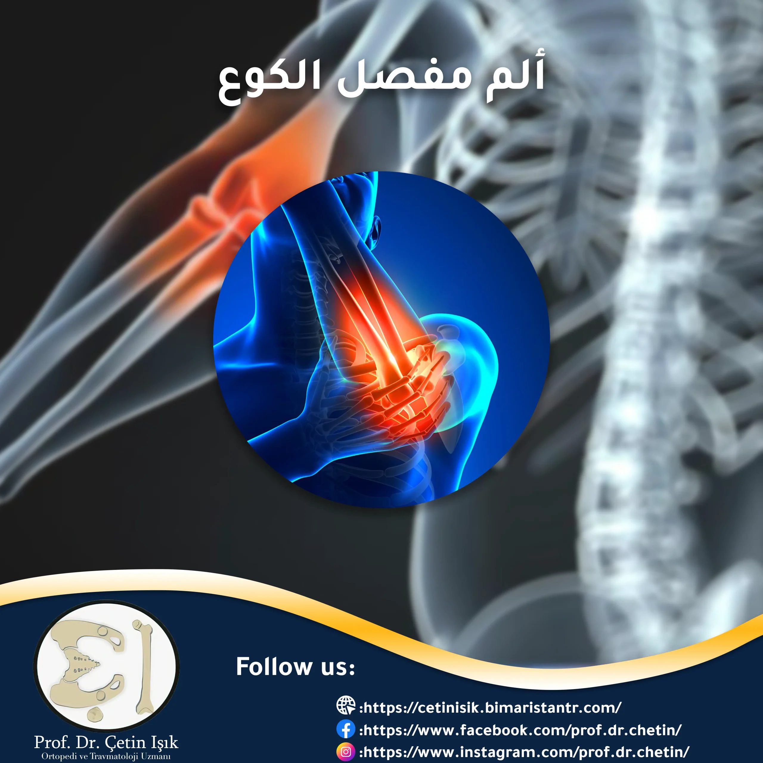 ألم مفصل الكوع – كيفية التخلص من الألم