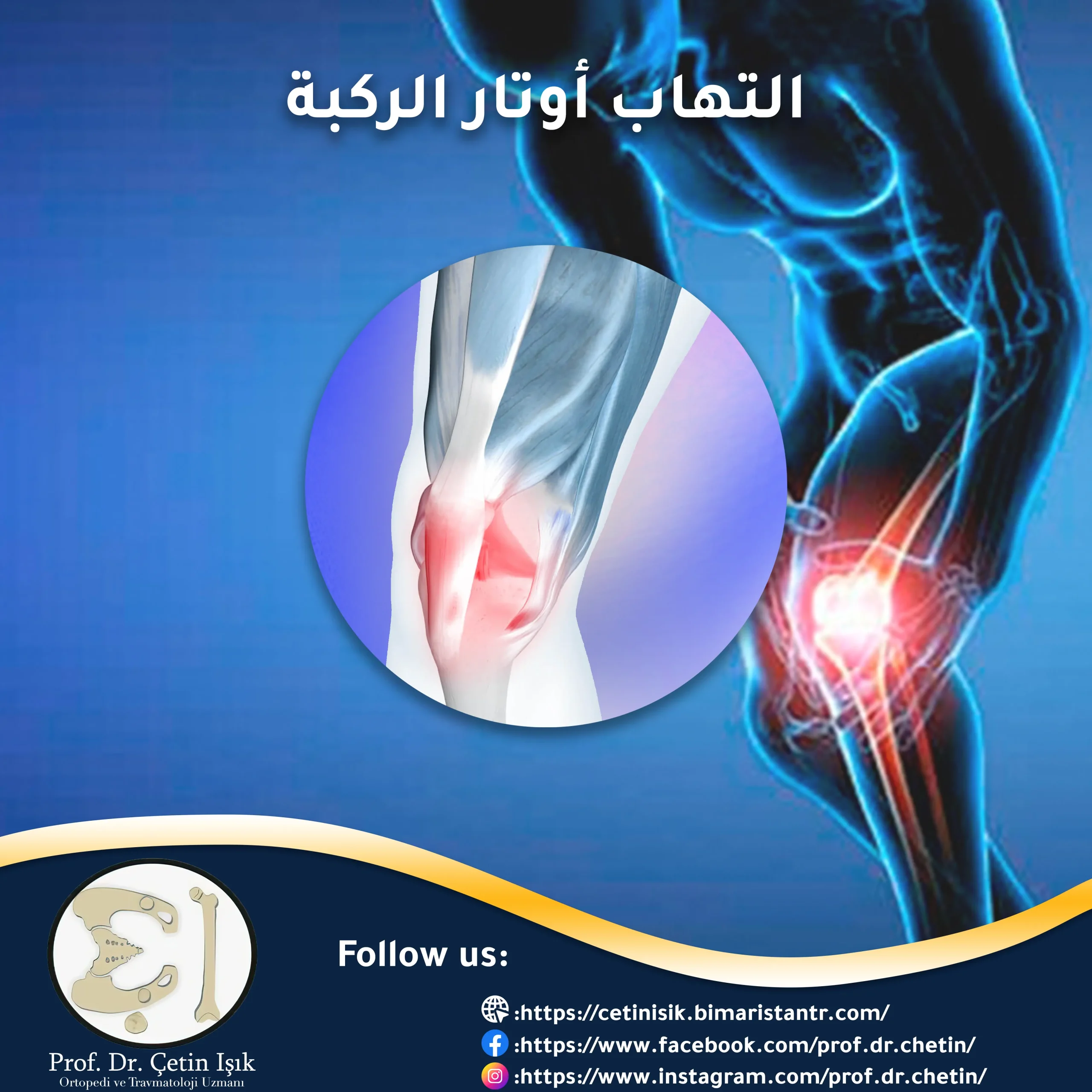 Knee tendinitis - ways to treat it at home