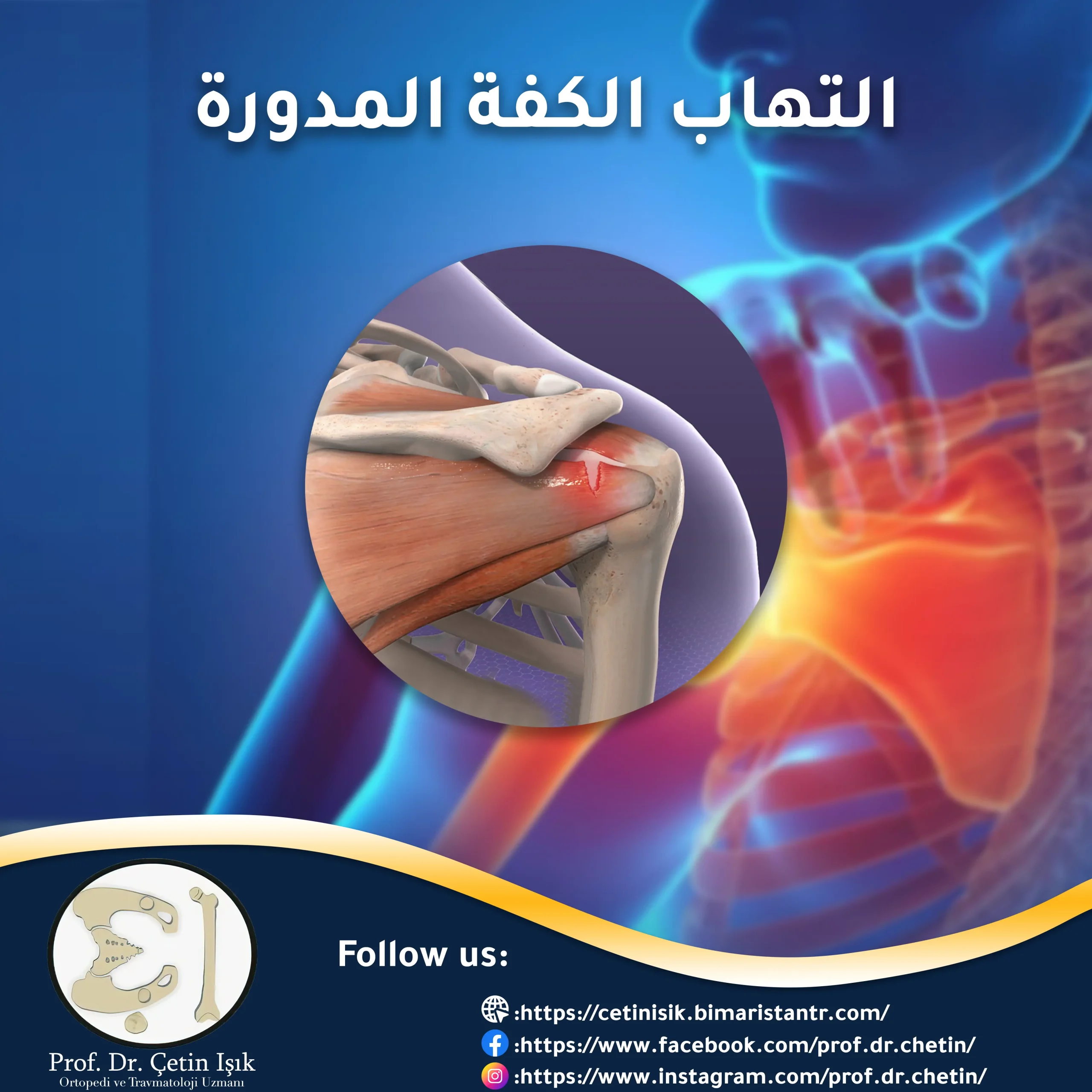 Rotator cuff inflammation - methods of diagnosis and treatment